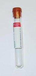 VACUTAINERTUBE 5.0 ML