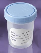 URINE SPECIMEN CONTAINER